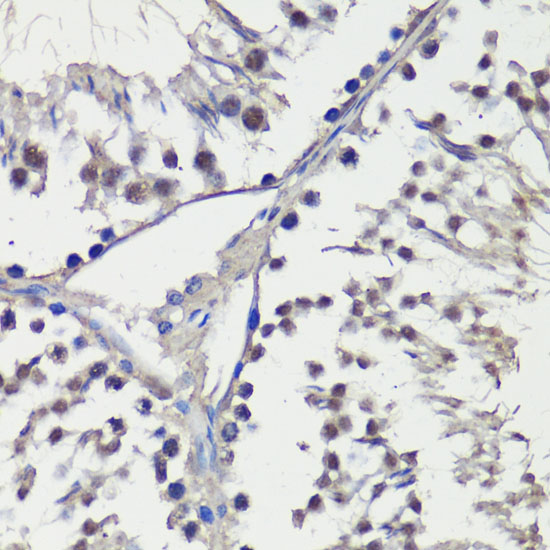 A16673_IHC_02_(900003).jpg